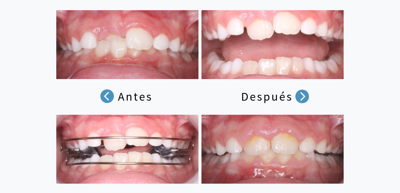 Caso 2